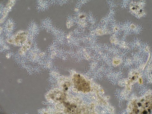 Nocardia 2 100 PH.JPG